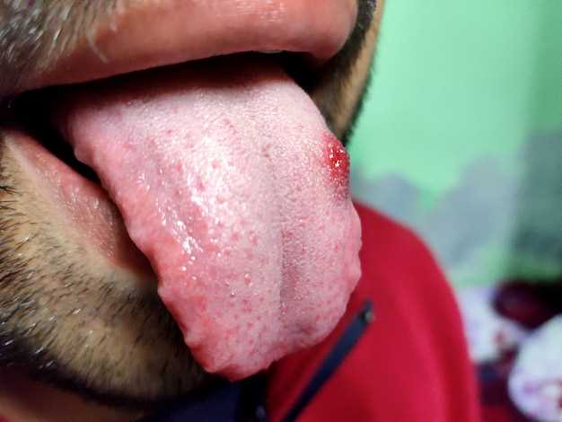 Dealing with Swollen Tongue