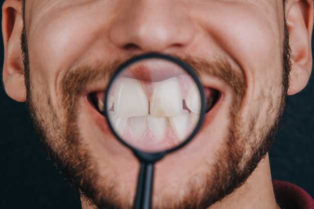 Can metronidazole cause white tongue