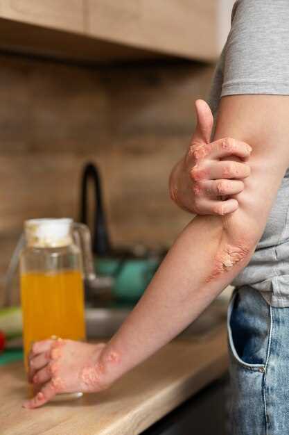 Does metronidazole cause a rash