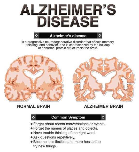 Metronidazole brain abscess