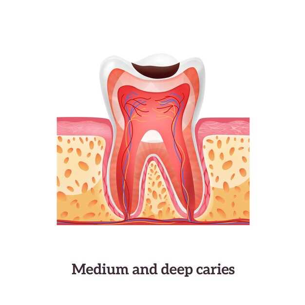 Metronidazole wisdom tooth infection